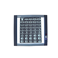 Hộp đèn đọc phim X-quang Micare ZG-1C (＞8000K, 30W)