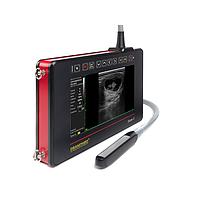 DRAMINSKI iScan 2 ເຄື່ອງສະແກນ Ultrasound (with linear probe)
