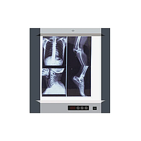 Hộp đèn đọc phim X-quang Micare MG-01 (360x440mm)