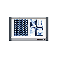 Hộp đèn đọc phim X-quang Micare MG-02 (740*440mm)