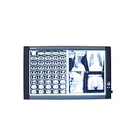 Hộp đèn đọc phim X-quang Micare ZG-2C (＞8000k, 60W)