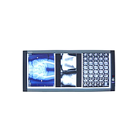 Hộp đèn đọc phim X-quang Micare ZG-3C (＞8000k, 90W)