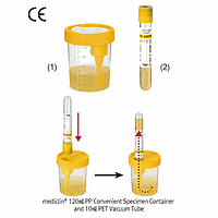 Ống Hút Chân Không, dùng cho Mẫu Nước Tiểu PET, có Nắp PP, Tiệt Trùng, 10㎖, Φ13×h106mm Daihan medical DM.Tub3001