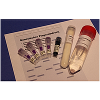 Bộ kit xác định dấu vân tay DNA cho pháp y PHYWE KLA-530-120